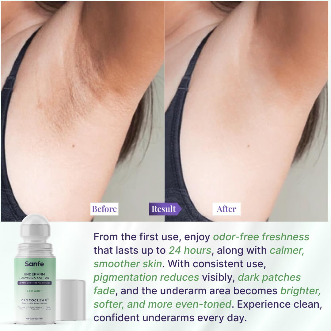 Underarm Lightening Roll On | Deodorant for Underarms | 50ml