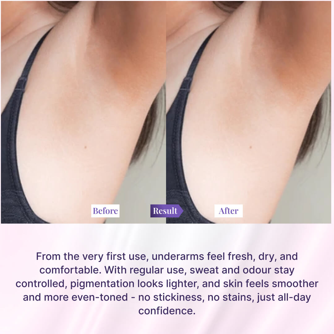 Underarm Lightening Roll On For Women - Cool Water, Oudh & Soft Touch (Pack of 3)