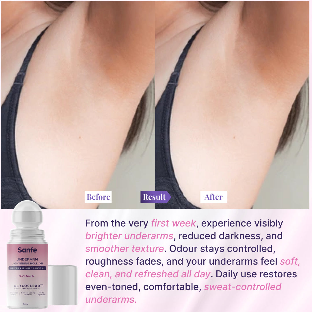 Underarm Lightening Roll On  - Soft Touch (Pack of 2)