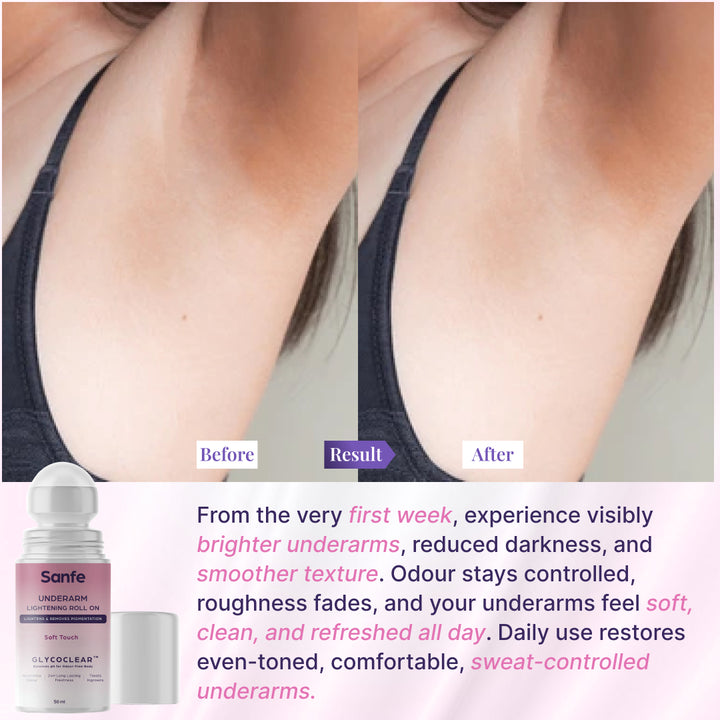 Underarm Lightening Roll On  - Soft Touch (Pack of 2)