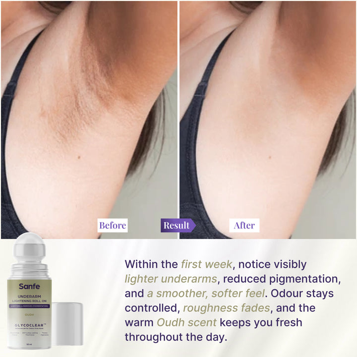 Underarm Lightening Roll On  - Oudh (Pack of 2)