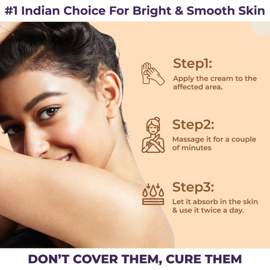 Sanfe Spotlite Cream For Dark Neck, Joints And Skinfolds (Pack of 2)